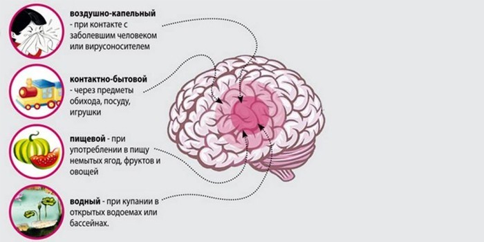 Менінгіт – симптоми та лікування етіотропне, патогенетичне, симптоматичне