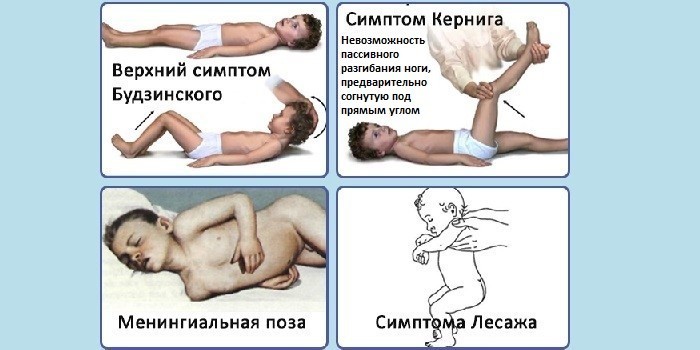 Перші ознаки менінгіту у дитини: як проявляється інфекційне захворювання
