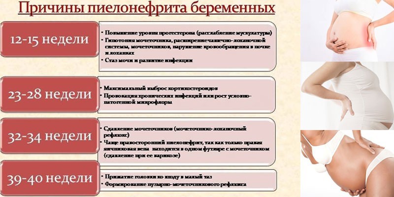 Причини пієлонефриту у жінок - види та прояви захворювання, діагностика, терапія