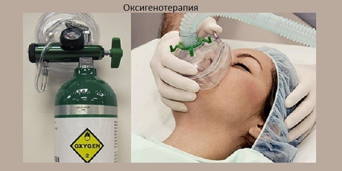 Силікоз: симптоми та лікування хвороби легень