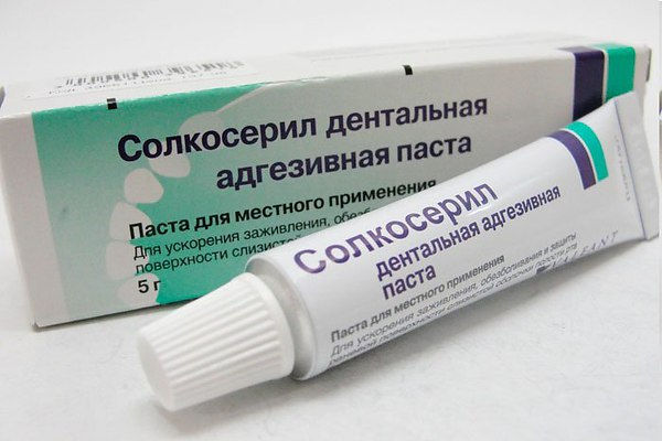 Запалення слизової оболонки порожнини рота та ясен: лікування набряків, причини почервоніння