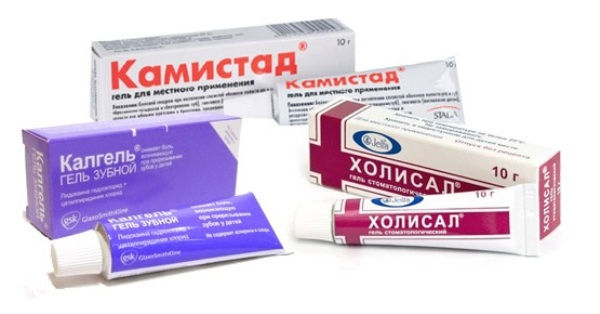 Зуб мудрості росте в щоку, що робити, якщо дряпає та травмує сусідній зуб