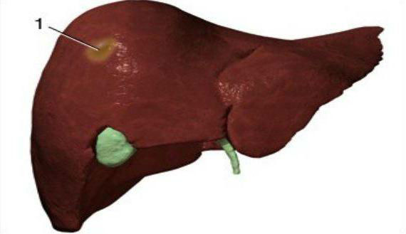 Біль у правому підребер'ї спереду або збоку, причини тупого та ниючого болю
