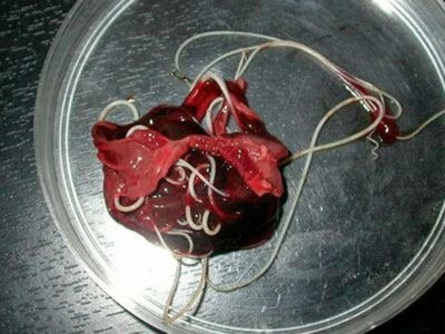 Діагностика аскаридозу у дорослих: як його визначити та виявити, аналізи крові