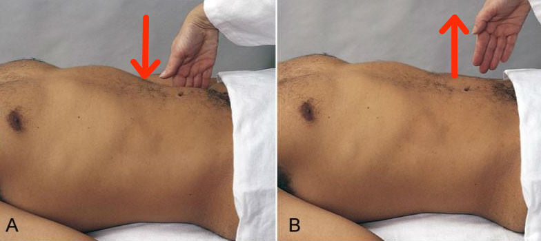 Симптоми апендициту: перші ознаки, як проявляється запалення у дорослих
