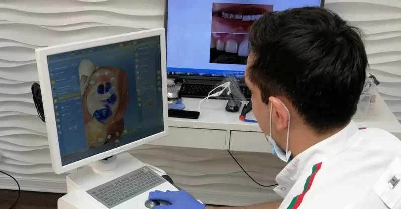 3D сканирование зубов