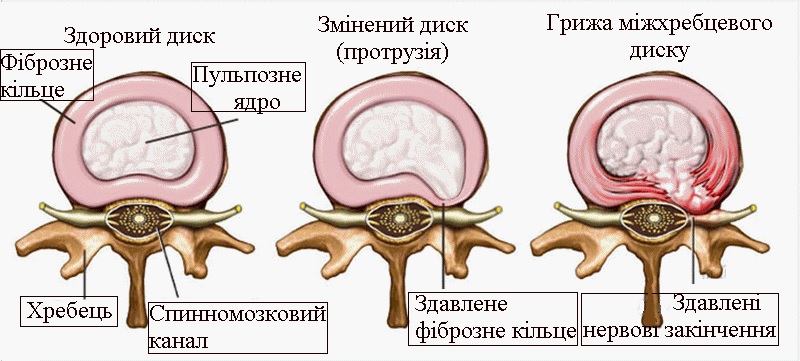 Зміни в диску