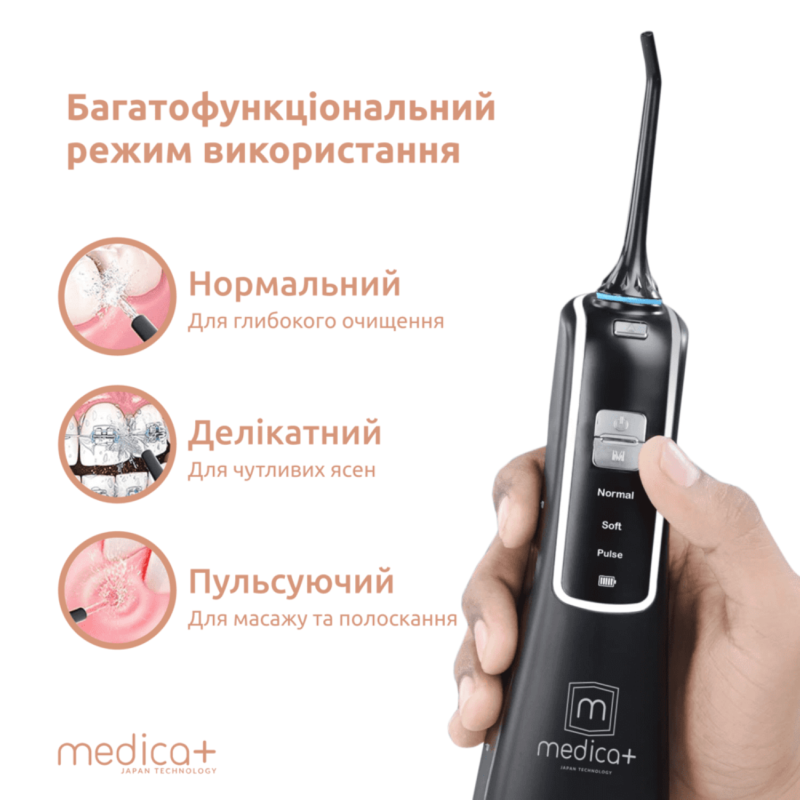 Як прибрати зубний наліт